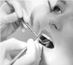 soins carrie dentaire